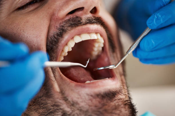 Best Pediatric Emergency Dentist in White Pine, TN